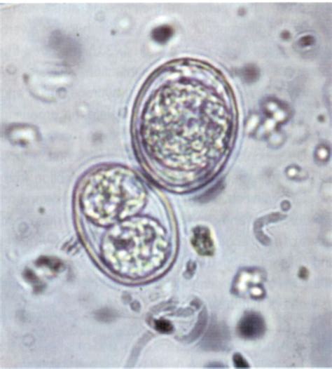  サルコシスト  - 静かな水域の奥深くで、寄生する単細胞生物の驚異！