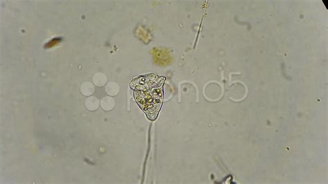  Vorticella! その渦巻く舞いは単細胞の優雅さ、そして驚異的な生命力！